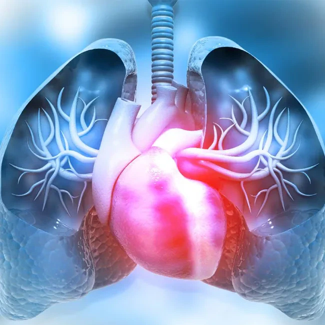 Lungs & Heart Conditions
